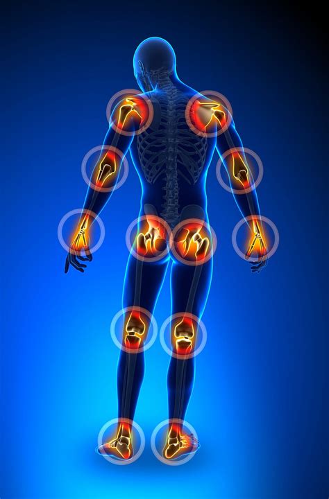 Inflammatory Polyarthritis: Diagnosis, Management and Treatment | by ...