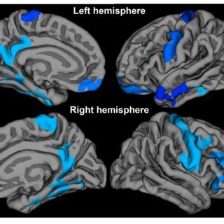 Correlations At Baseline Between Cortical Thickness And Tmt B A And