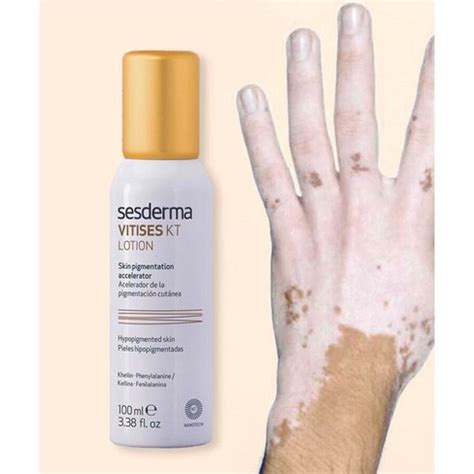 Sesderma Vitises Kt Lo O Para Zonas Vitiligo Sweetcare United States