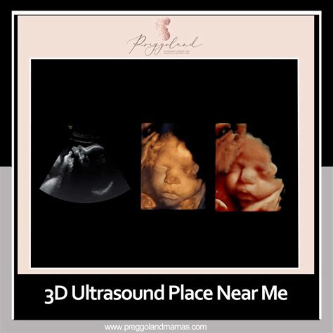 Learn about the 3D Ultrasound Places near you! - Social Social Social ...