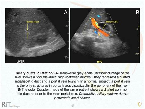 Imaging Acute Abdomen Part 1