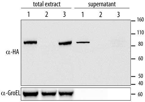 Expression Analysis Of Xopd Strains Xopd Ha And