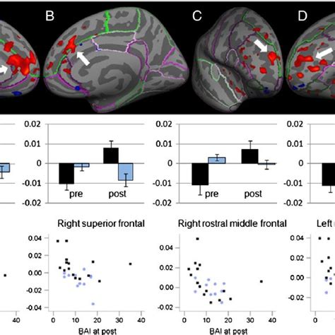 Functional Connectivity Between The Seed Region In The Right Amygdala Download Scientific