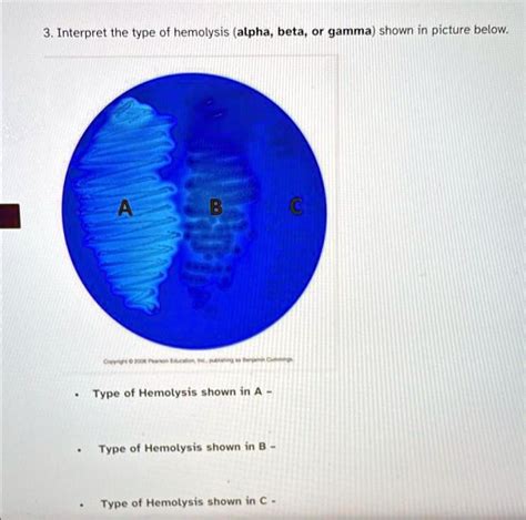 SOLVED: microbiology 3.Interpret the type of hemolysis alpha,beta,or ...