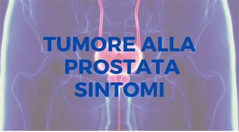 Tumore Alla Prostata Sintomi Ed Esami Utili