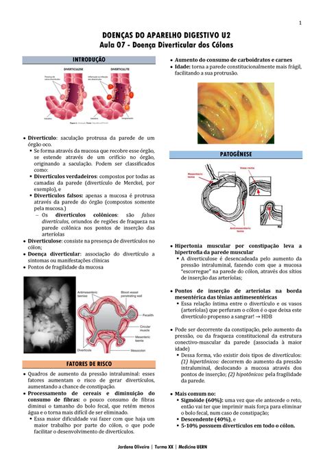 Doença Diverticular Dos Cólons DoenÇas Do Aparelho Digestivo U Aula