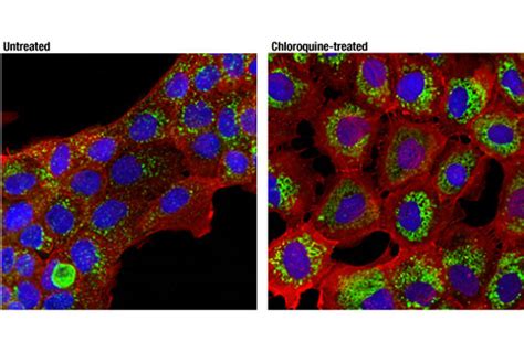 Lamp1 D4o1s Mouse Mab Cell Signaling Technology