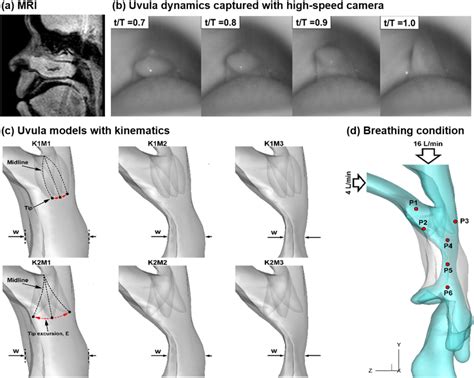 Pharyngeal airway models and uvula kinematics: a constricted pharyngeal... | Download Scientific ...