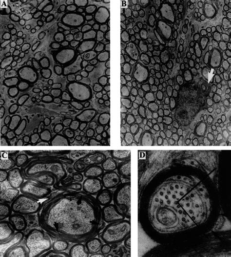 Ultrastructure of the optic nerve. (A) Survey view of wild-type optic... | Download Scientific ...