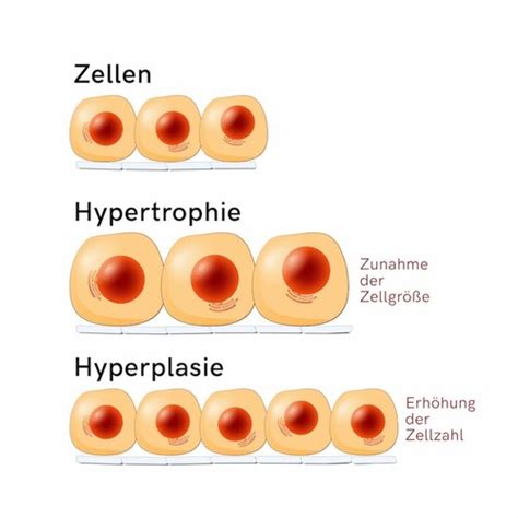 Allgemeine Pathologie Flashcards Quizlet