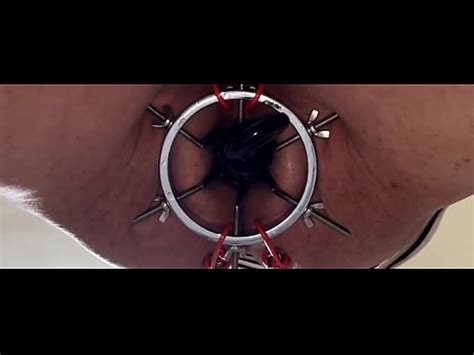 35 Cm Anal Beads Insertion XNXX