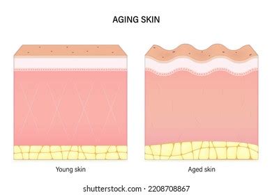 Aging Skin Comparison Young Aged Skin Stock Vector (Royalty Free) 2208708867 | Shutterstock