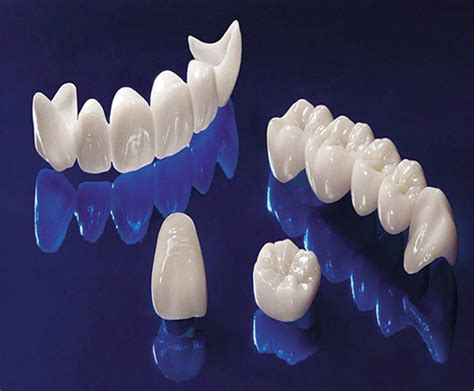 What Is Zirconia Crowns And Bridges Southex Dental