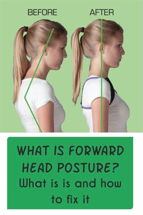 How To Correct Forward Head Posture Forward Head Posture Correction