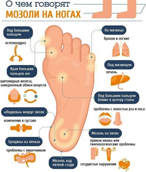 Сухая мозоль со стержнем и другие омозолелости: лечение - Babulya