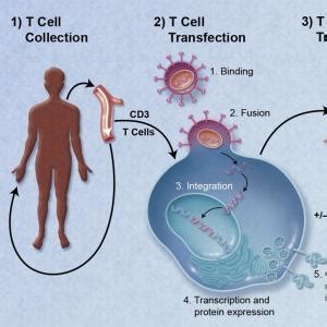 Multiples Myelom Car T Zellen Nachweislich Geeignet F R Behandlung