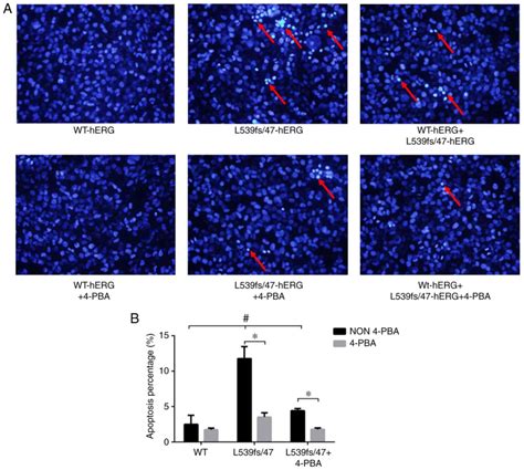 Human etheràgogorelated gene mutation L539fs 47hERG leads to cell