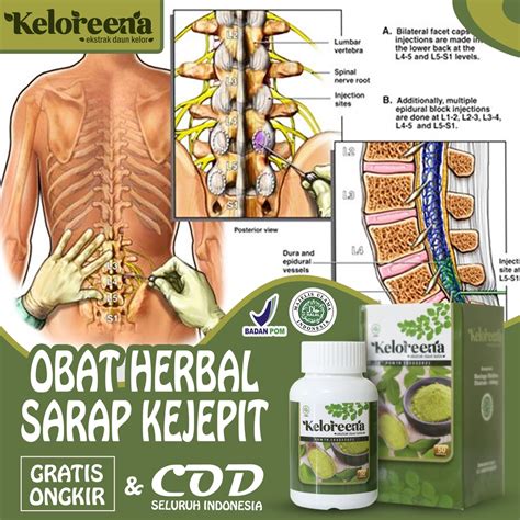 Jual Obat Syaraf Kejepit Sarap Kejepit Di Leher Obat Sakit Pinggang