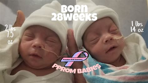 Premature Twins 28 Weeks