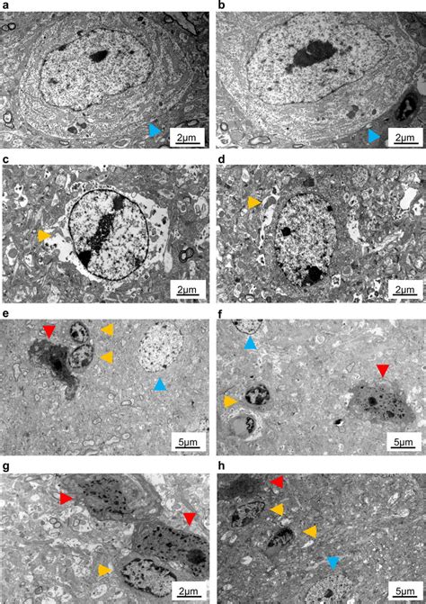 Electron Microscopy Of Cortical Neuron Morphology Shown Are Typical