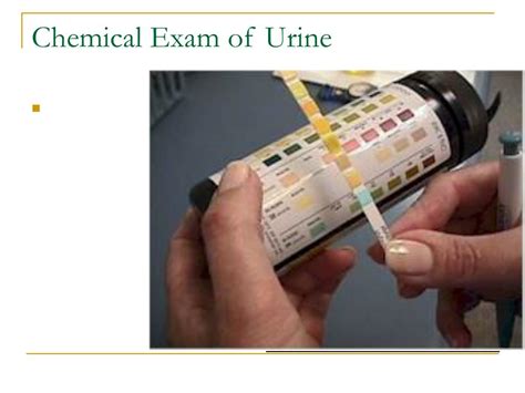 Ppt Clinical Urinalysis Review Powerpoint Presentation Free Download