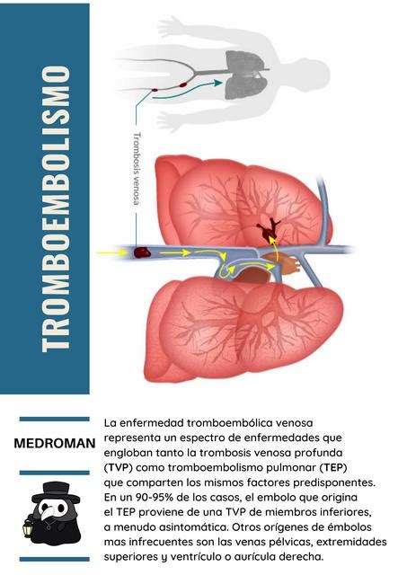 Tromboembolismo Pulmonar Medroman Udocz