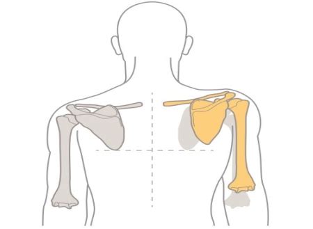 Effective Treatment For Scapular Dyskinesis Orthopaedic Associates Of