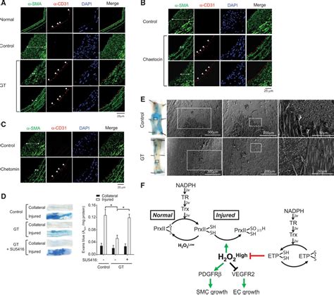 Vascular Injury Involves The Overoxidation Of Peroxiredoxin Type II And