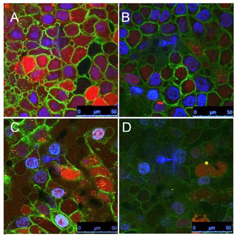 Confocal Multichannel Microscopy Of Stat D And Aunp Nuap Stat D Uptake