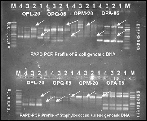 Rapd Pcr Profiles Of Genomic Dna Of E Coli Up And S Aureus Down