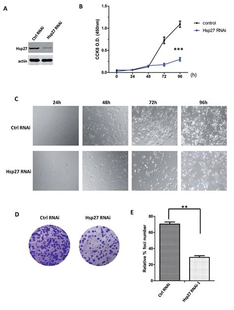 Downregulation Of Hsp27 Inhibits Proliferation Migration And Invasion