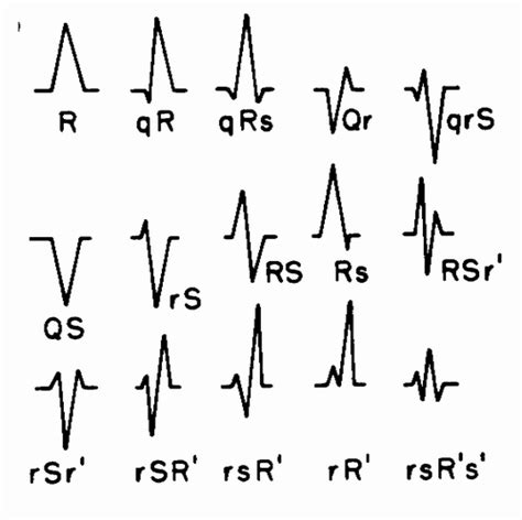 Kmity QRS komplexu EKG Medicína nemoci studium na 1 LF UK