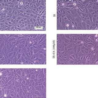 Protective Effect Of Fa Against Ir Induced Cell Apoptosis In Hlecs A