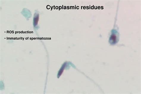 Ppt Re Evaluation Of Sperm Morphology Assessment And Results In Light