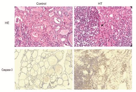 Representative Image Of Hematoxylin Eosin He Staining And Caspase 3