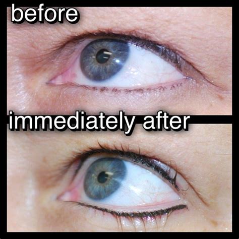 Permanent Eyeliner Top And Bottom Permanent Eyeliner Permanent Makeup Eyeliner