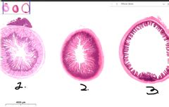 Lec 11 Intestines Anal Canal Quizlet