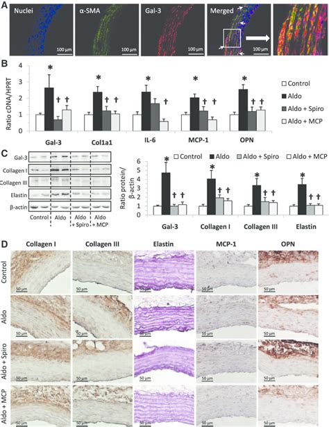 Galectin 3 Gal 3 Mediated Aldosterone Aldo Induced Arterial