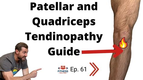 Patellar And Quadriceps Tendinopathy Evidence Based Guide Definition Anatomy P1 Fpf Show