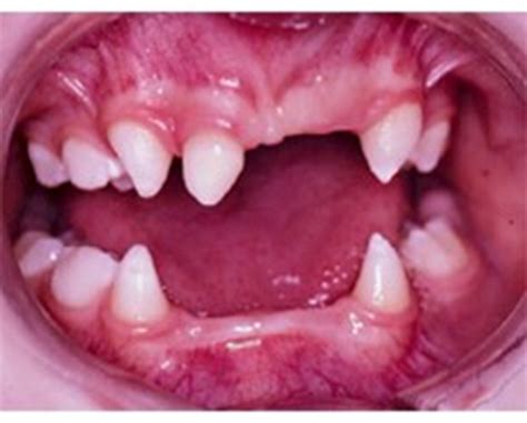 Chapter 6 Tooth Development And Eruption Flashcards Quizlet