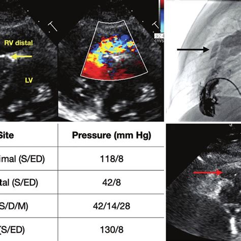 A Two Dimensional And Color Doppler Echocardiography Images In