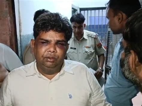 Case Of Assault On Advocate Purushottam Saini Heated Up अधिवक्ता पुरुषोत्तम सैनी के साथ मारपीट