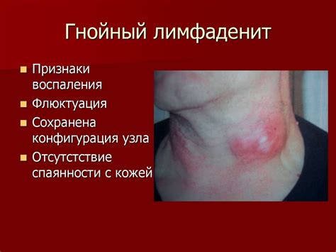 Фурункул на интимном месте симптомы фото