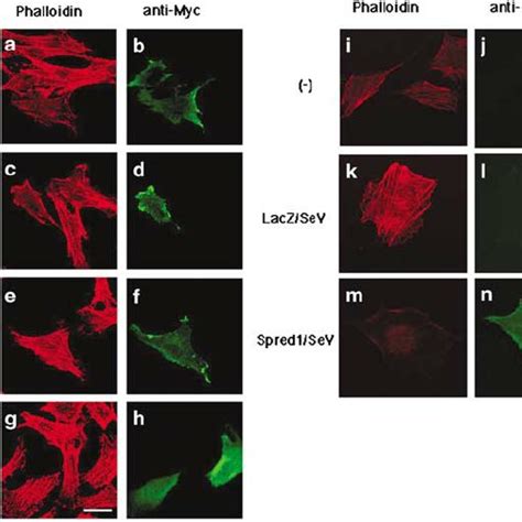 Disruption Of Stress Fibers By Spred Overexpression Nih T Cells A