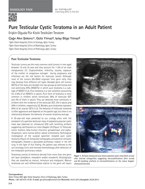 Pdf Pure Testicular Cystic Teratoma In An Adult Patient