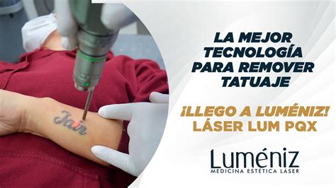 LÁSER DE PICOSEGUNDOS para remover tatuajes YouTube