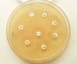 Mueller Hinton Agar MHA Composition Principle 50 OFF