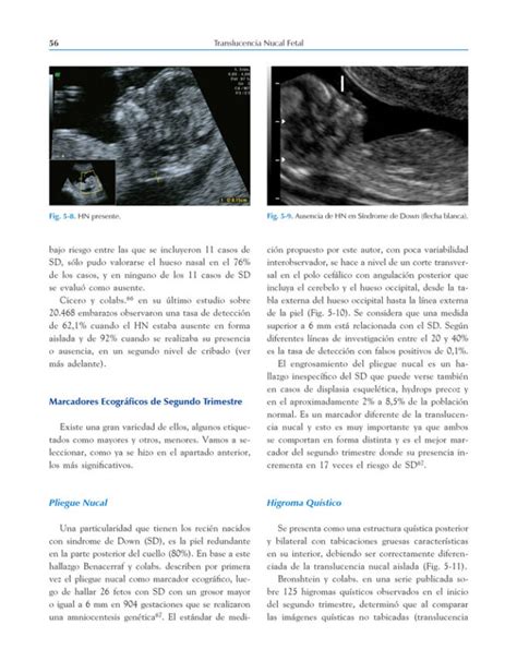 Translucencia Nucal Fetal Era Edici N Campus