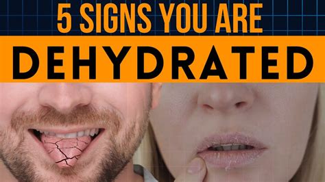 5 Signs You Are Dehydrated How To Know If You Are Dehydrated YouTube