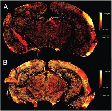 Depth Encoded Mip Images Of Brain Slice Microvasculature A Before And